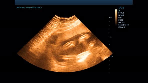 Ultrasound of a Pregnant Woman. Ultrasound of a Woman Pregnant at 12 Weeks.