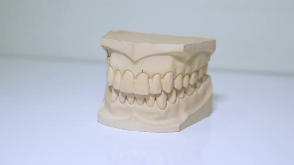 A custom dental mould