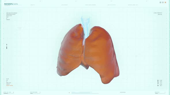 Medical system has detected the cancer cells in the patients organ at a hospital alt