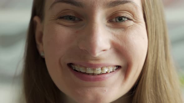 Woman Showing Her Braces in Magnifying Glass