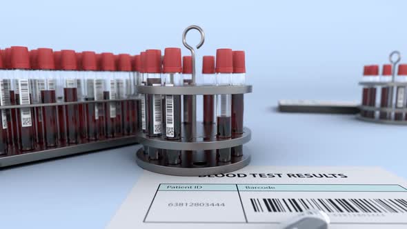 Test Tubes with Blood Sample in Reserarch Lab