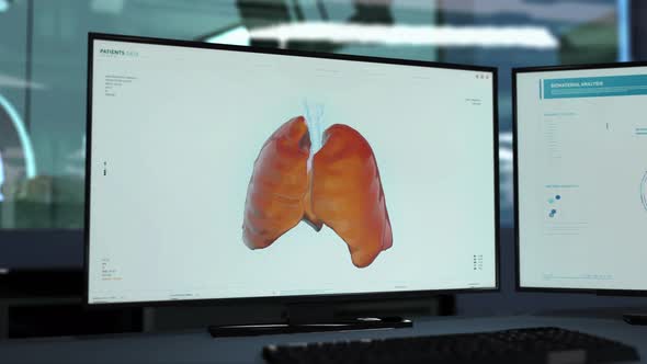 3d Animation Of Lungs On Computer Screen In Biological Study To Set Diagnosis alt
