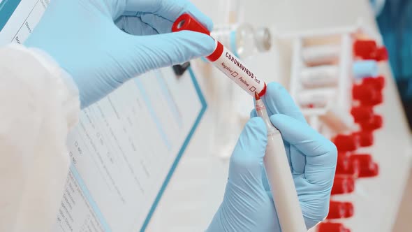 Vertical Footage of Doctors Hand Holding Tube with Blood Test for Coronavirus