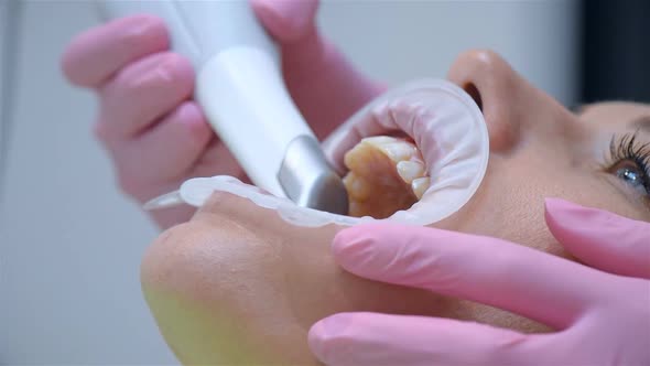 Dentist Scaning Patient's Teeth With 3d Scanner In Dental Clinic.