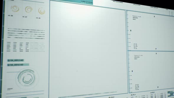 Computer user interface of modern medical research for covid-19 pneumonia. alt