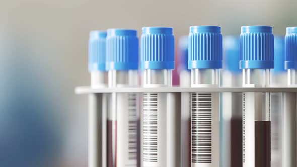 Blood samples in a test-tube centrifuge. Bunch of tubes in a lab environment. 4K