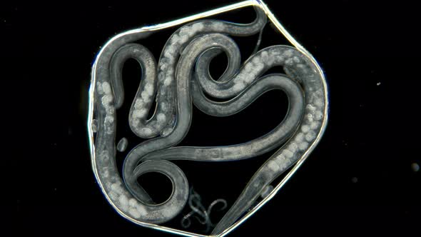 Nematode Worm, Parasite, Pest and Fish Food, Under a Microscope