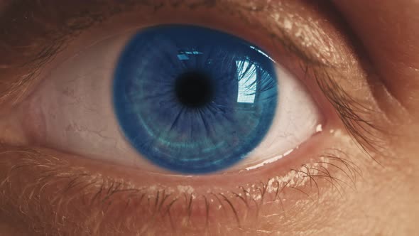 The Blue Eye is an Extreme Closeup of the Iris and Pupil Widening and Tapering