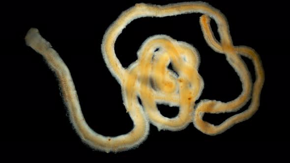 A Worm Under a Microscope, Long, Like a Parasitic.