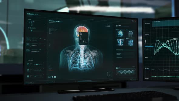 Interface of the body scanning system has found the deadly tumor in the brain alt