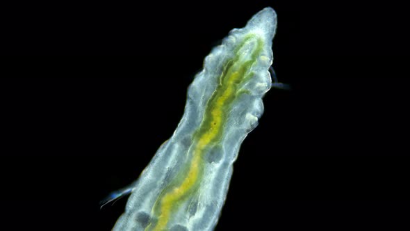 Worm Manayunkia Baicalensis Under a Microscope, of the Family Fabriciidae.