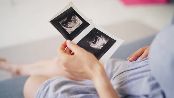 Beautiful Pregnant Woman Wife Holding Ultrasound Baby Picture in Her Hand
