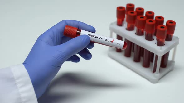 Negative Hepatitis C Test, Doctor Showing Blood Sample in Tube, Health Checkup