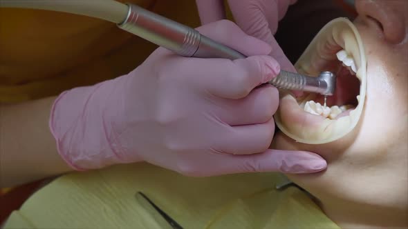 Close Up Female Hands Professional Doctor Stomatologist at Work. Person Undergoes a Medical