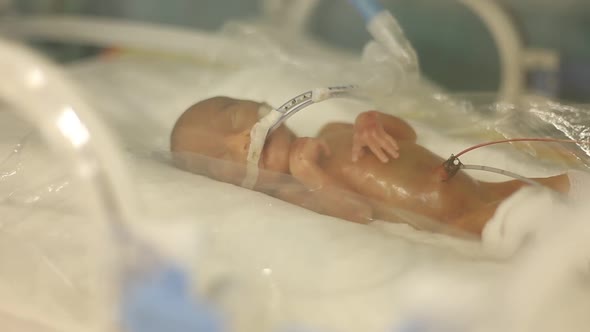 Premature Newborn Baby in the Tub