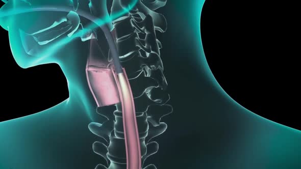 Entering the stomach with the endoscope