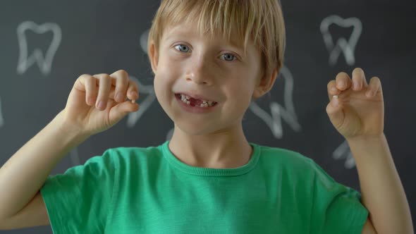 Little Boy Shows That Some of His Milk Teeth Had Fallen Out. Concept of Tooth Change in Children