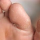 Female Feet During an Acid Peeling Procedure - VideoHive Item for Sale