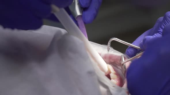 Dentist Conducts Dental Hygiene To the Patient