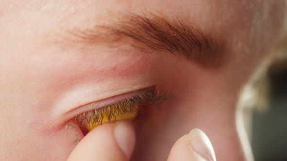 Closeup of Eye Wearing Yellow Lens Young Woman in Decorative Lenses