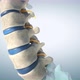 Human Lumbar Spine Model - VideoHive Item for Sale