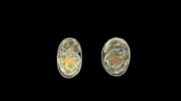 Crustacea Amphipoda Eggs with Embryos Under a Microscope, Gammarida Infraorder