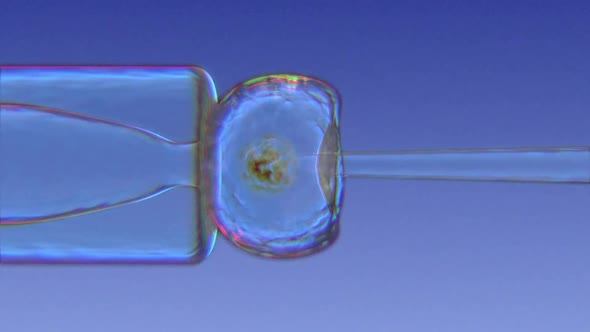 In Vitro Fertilization.Needle Puncture Of Human Egg And Sperm Injection