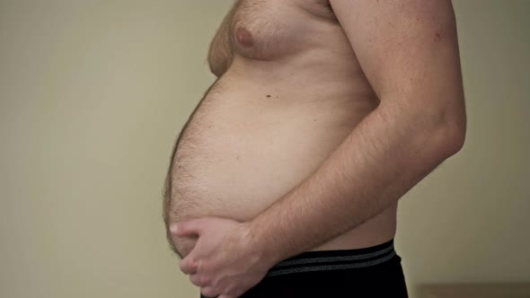 Man Shows with His Hands His Fat Folds on His Belly