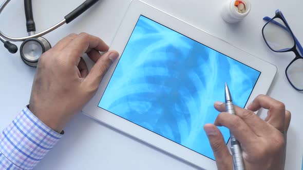 Male Doctor Hold Analyzing Xray Photography on Digital Tablet Closeup