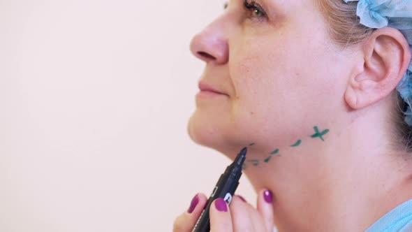 Closeup Side View of Adult Woman Standing Calmly While Nurse Putting Markings with Marker Pen Along