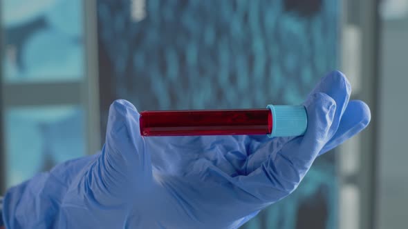 Vertical Video Close Up of Hand with Gloves Holding Vacutainer