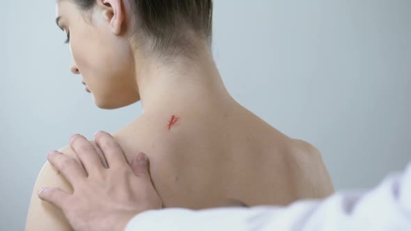 Therapist Examining Wound on Female Back, Using Magnifying Glass, Scar Healing