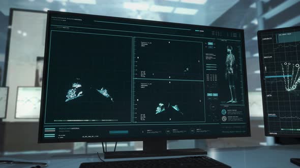 Diagnosing dangerous covid-19 pneumonia illness in the lungs of a sick person alt