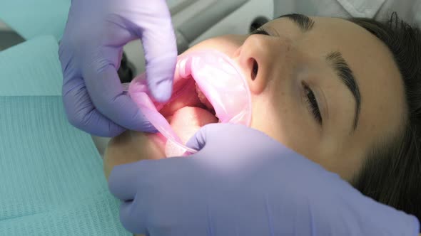 Close up of a patient at dentist