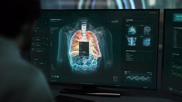 Specialist Analyzing Lungs Condition In Modern Computer Program To Detect Virus alt