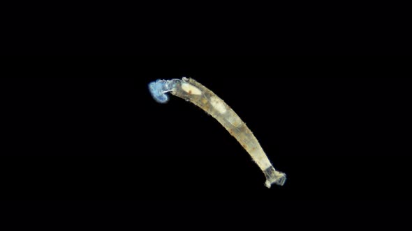 Rotifera Family Flosculariidae Under a Microscope Possibly Limnias Sp