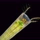 Trichoptera Larva Under a Microscope Family Leptoceridae - VideoHive Item for Sale