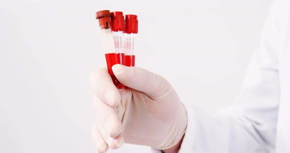 Mid section of lab technician holding blood sample in tube