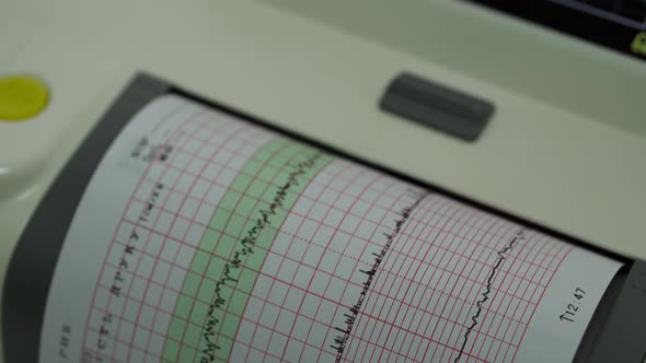 Electronic Cardiotocography Machine Monitoring Fetal Heart Contractions Of Uterus