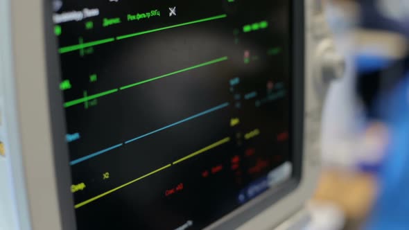 Heart beat of a patient on the screen of computers during operation in the hospital.