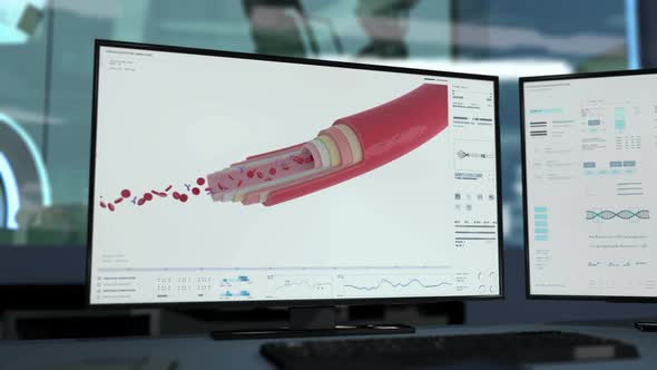 Futuristic software is conducting the artery health examination process alt