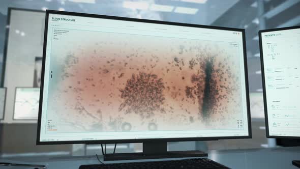 Scientific Research On A Microscopic Level At A Blood Medical Laboratory