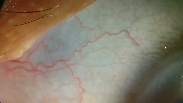 Veins In Moving Human Eye