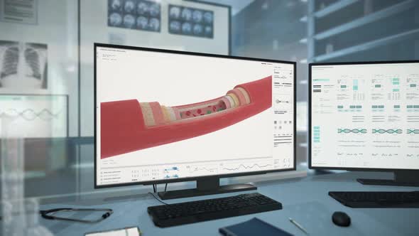 Futuristic X-Ray Scanner Interface Checks Artery For Covid-19 Disease Cells alt