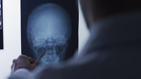 Analyzing a skull x-ray