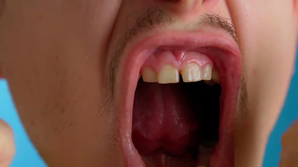 Man Close Up Portrait of Screaming Male Looking in Camera with Furious View Feeling Anger and Stress