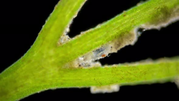 Chironomidae Larva Under a Microscope Order Diptera