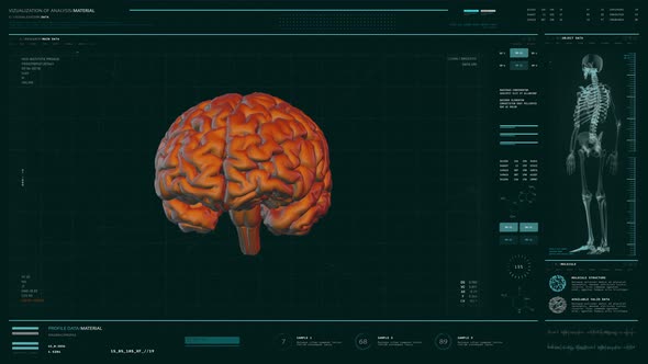 Futuristic X-ray Diagnostic Scanner Equipment Analysis Of Human Brain Organ alt