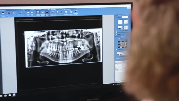 The Doctor Looks at Xrays of Teeth on the Screen