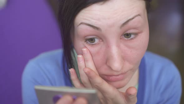 Swelling of the Girl's Face an Allergic Reaction